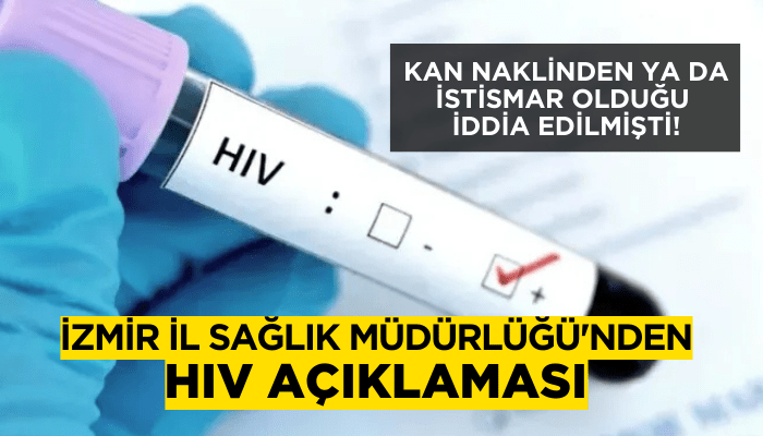 İzmir İl Sağlık Müdürlüğü'nden HIV açıklaması