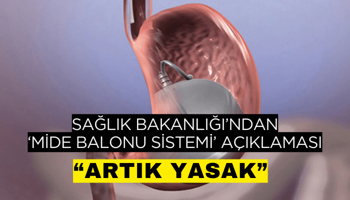 Yutulabilir mide balonları, yasaklandı